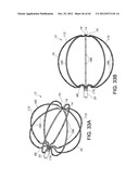 METHODS FOR DETECTION OF CARDIAC RHYTHM DISORDERS USING BASKET STYLE     CARDIAC MAPPING CATHETER diagram and image