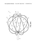 METHODS FOR DETECTION OF CARDIAC RHYTHM DISORDERS USING BASKET STYLE     CARDIAC MAPPING CATHETER diagram and image