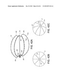 METHODS FOR DETECTION OF CARDIAC RHYTHM DISORDERS USING BASKET STYLE     CARDIAC MAPPING CATHETER diagram and image