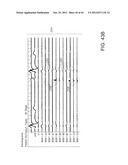 METHODS FOR DETECTION OF CARDIAC RHYTHM DISORDERS USING BASKET STYLE     CARDIAC MAPPING CATHETER diagram and image