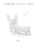 METHOD AND SYSTEM FOR OPTICALLY EVALUATING PROXIMITY TO THE INFERIOR     ALVEOLAR NERVE IN SITU diagram and image