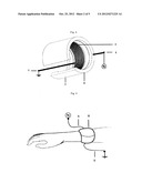 DEVICE FOR THE PLANAR TREATMENT OF AREAS OF HUMAN OR ANIMAL SKIN OR MUCOUS     MEMBRANE SURFACES BY MEANS OF A COLD ATMOSPHERIC PRESSURE PLASMA diagram and image