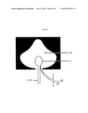 DEVICE FOR THE PLANAR TREATMENT OF AREAS OF HUMAN OR ANIMAL SKIN OR MUCOUS     MEMBRANE SURFACES BY MEANS OF A COLD ATMOSPHERIC PRESSURE PLASMA diagram and image