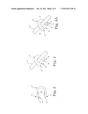 Fibroid Treatment System and Method diagram and image