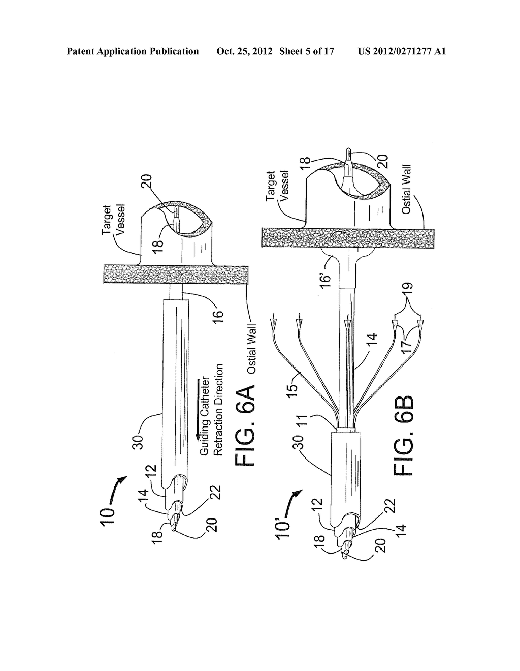 EXPANDABLE CATHETER SYSTEM FOR PERI-OSTIAL INJECTION AND MUSCLE AND NERVE     FIBER ABLATION - diagram, schematic, and image 06