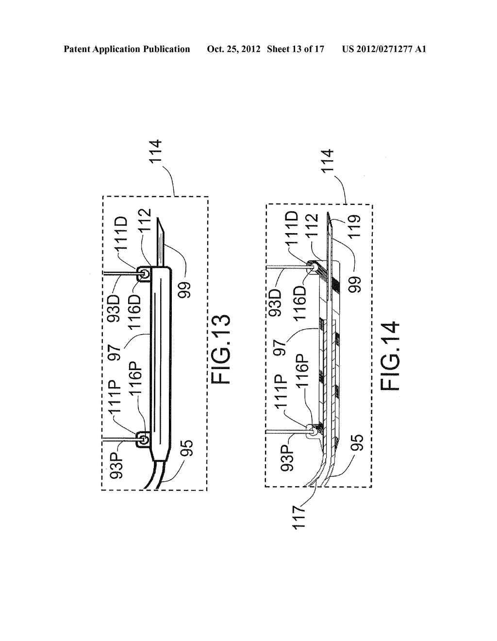 EXPANDABLE CATHETER SYSTEM FOR PERI-OSTIAL INJECTION AND MUSCLE AND NERVE     FIBER ABLATION - diagram, schematic, and image 14