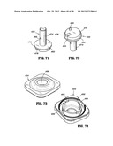 Surgical Instrument diagram and image