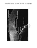 METHODS AND SYSTEMS FOR PROCESSING IMAGES OF THE ANTERIOR CHAMBER ANGLE OF     AN EYE diagram and image