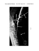 METHODS AND SYSTEMS FOR PROCESSING IMAGES OF THE ANTERIOR CHAMBER ANGLE OF     AN EYE diagram and image