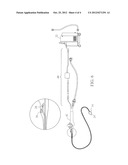 FLUID CONTROL SYSTEM FOR A MEDICAL DEVICE diagram and image