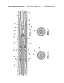 CRYOSURGICAL PROBE WITH ADJUSTABLE SLIDING APPARATUS diagram and image