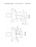 METHOD AND DEVICES FOR COAGULATION OF TISSUE diagram and image