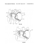 METHOD AND DEVICES FOR COAGULATION OF TISSUE diagram and image