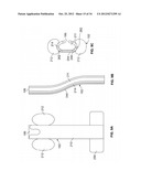 METHOD AND DEVICES FOR COAGULATION OF TISSUE diagram and image