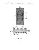 MEDICAL INSTRUMENT AND METHOD OF USE diagram and image