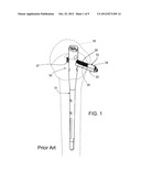 CONTROLLING BONE COMPRESSION diagram and image