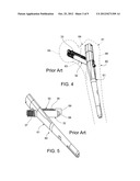 CONTROLLING BONE COMPRESSION diagram and image