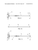 CONTROLLING BONE COMPRESSION diagram and image