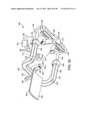 ORTHOPEDIC SURGICAL GUIDE diagram and image