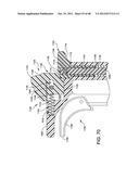 ORTHOPEDIC SURGICAL GUIDE diagram and image