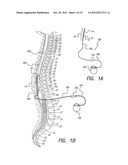 INSERTION TOOL FOR PADDLE-STYLE ELECTRODE diagram and image