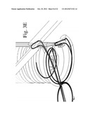 Devices and Methods for Continuous Surgical Suturing diagram and image