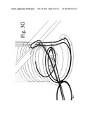 Devices and Methods for Continuous Surgical Suturing diagram and image