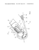 APPARATUS FOR PLACING MEDICAL IMPLANTS diagram and image