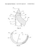 APPARATUS FOR PLACING MEDICAL IMPLANTS diagram and image