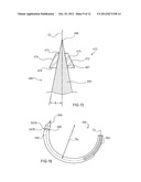 APPARATUS FOR PLACING MEDICAL IMPLANTS diagram and image