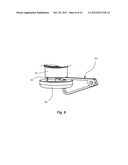 RETRIEVAL MECHANISMS FOR IMPLANTABLE MEDICAL DEVICES diagram and image