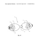 RETRIEVAL MECHANISMS FOR IMPLANTABLE MEDICAL DEVICES diagram and image