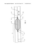 SLIDEABLE VASCULAR FILTER diagram and image