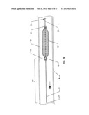 SLIDEABLE VASCULAR FILTER diagram and image