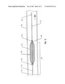 SLIDEABLE VASCULAR FILTER diagram and image