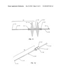 SLIDEABLE VASCULAR FILTER diagram and image