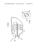 EXPANDABLE IMPLANT DEVICES FOR FILTERING BLOOD FLOW FROM ATRIAL APPENDAGES diagram and image