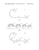 APPARATUS AND METHOD FOR TREATING MYOFASCIAL TRIGGER POINTS diagram and image