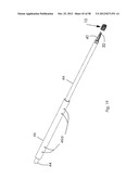 METHOD AND APPARATUS FOR SPINAL FACET FUSION diagram and image