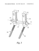 ELONGATED CONNECTING ELEMENTS FOR MINIMALLY INVASIVE SURGICAL PROCEDURES diagram and image