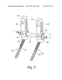 ELONGATED CONNECTING ELEMENTS FOR MINIMALLY INVASIVE SURGICAL PROCEDURES diagram and image