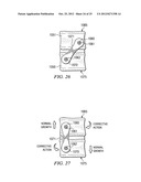 BONE ALIGNMENT IMPLANT AND METHOD OF USE diagram and image