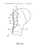 PATIENT-SPECIFIC FRACTURE FIXATION INSTRUMENTATION AND METHOD diagram and image
