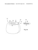 ANCHORING UNITS FOR LEADS OF IMPLANTABLE ELECTRIC STIMULATION SYSTEMS AND     METHODS OF MAKING AND USING diagram and image