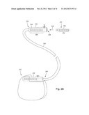 ANCHORING UNITS FOR LEADS OF IMPLANTABLE ELECTRIC STIMULATION SYSTEMS AND     METHODS OF MAKING AND USING diagram and image