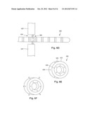 ANCHORING UNITS FOR LEADS OF IMPLANTABLE ELECTRIC STIMULATION SYSTEMS AND     METHODS OF MAKING AND USING diagram and image