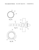 ANCHORING UNITS FOR LEADS OF IMPLANTABLE ELECTRIC STIMULATION SYSTEMS AND     METHODS OF MAKING AND USING diagram and image