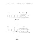 ANCHORING UNITS FOR LEADS OF IMPLANTABLE ELECTRIC STIMULATION SYSTEMS AND     METHODS OF MAKING AND USING diagram and image