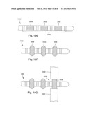 ANCHORING UNITS FOR LEADS OF IMPLANTABLE ELECTRIC STIMULATION SYSTEMS AND     METHODS OF MAKING AND USING diagram and image