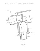 ARTIFICIAL AIRWAY INTERFACES AND METHODS THEREOF diagram and image